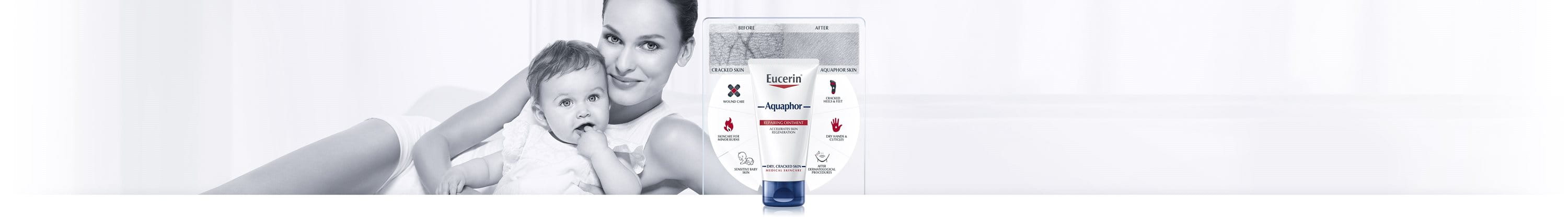 Aquaphor salv kahjustatud nahale